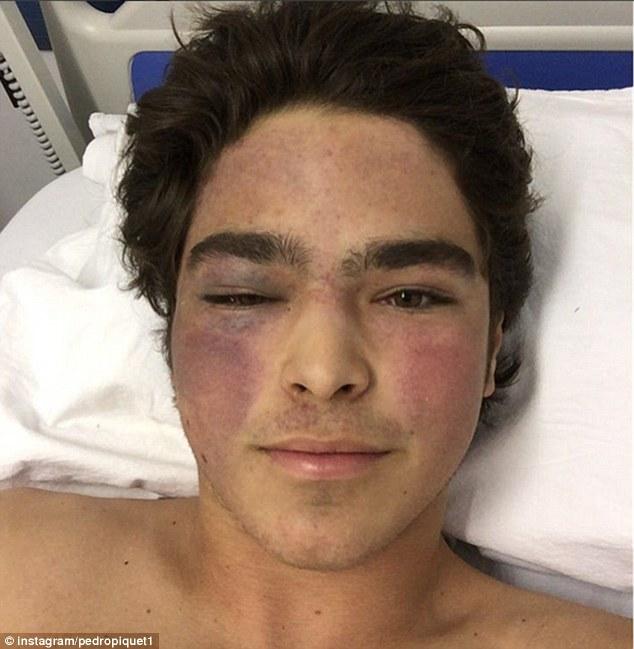 import ems (featured/category)